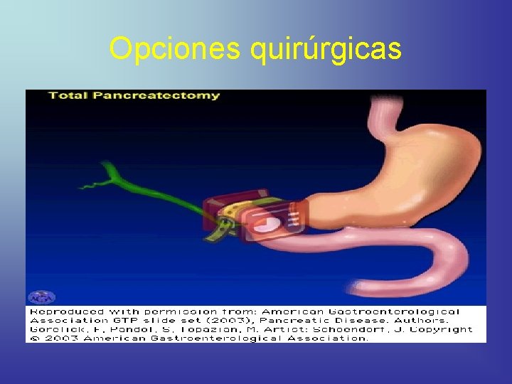 Opciones quirúrgicas 