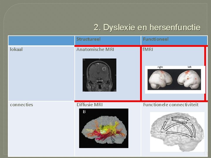 2. Dyslexie en hersenfunctie Structureel Functioneel lokaal Anatomische MRI f. MRI connecties Diffusie MRI