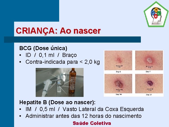 CRIANÇA: Ao nascer BCG (Dose única) • ID / 0, 1 ml / Braço