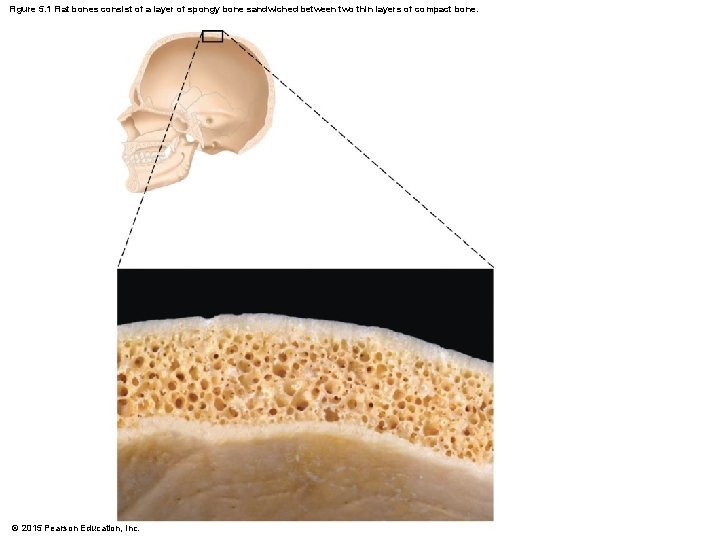 Figure 5. 1 Flat bones consist of a layer of spongy bone sandwiched between