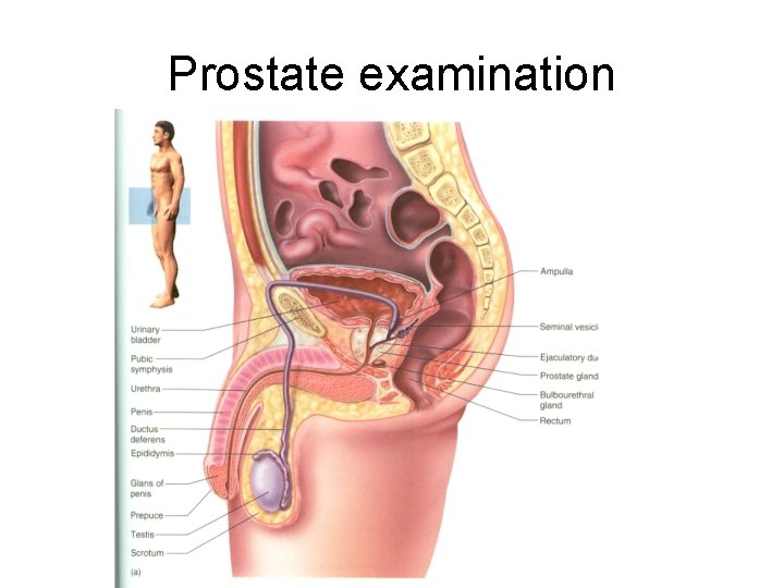 Prostate examination 