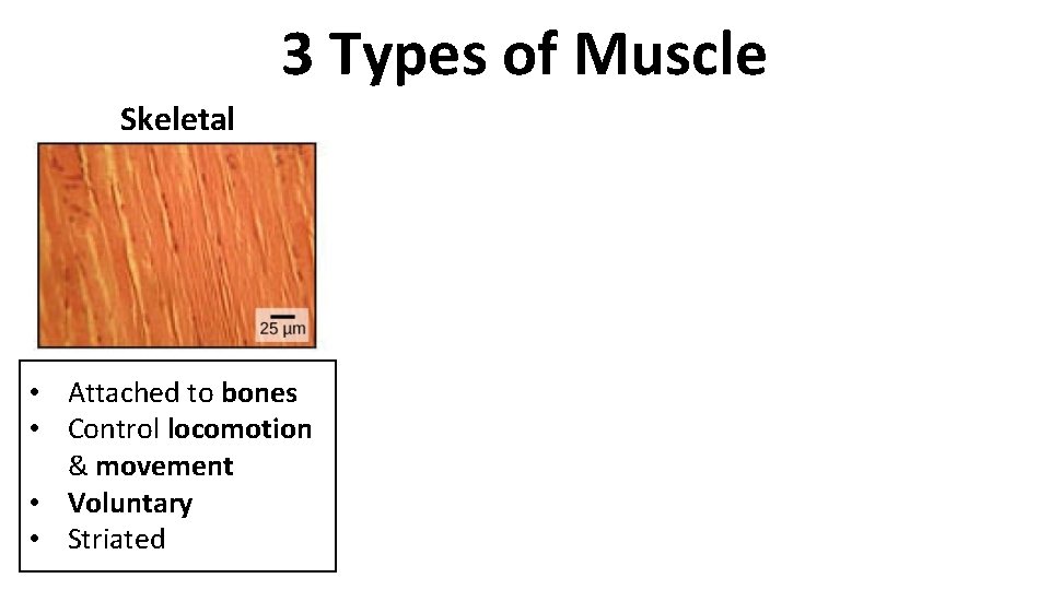 3 Types of Muscle Skeletal • Attached to bones • Control locomotion & movement