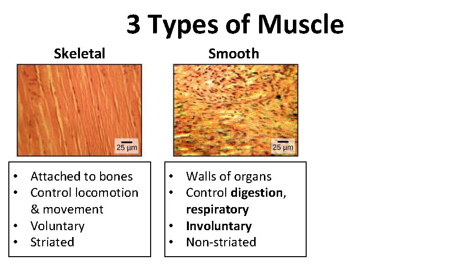 3 Types of Muscle Skeletal • Attached to bones • Control locomotion & movement