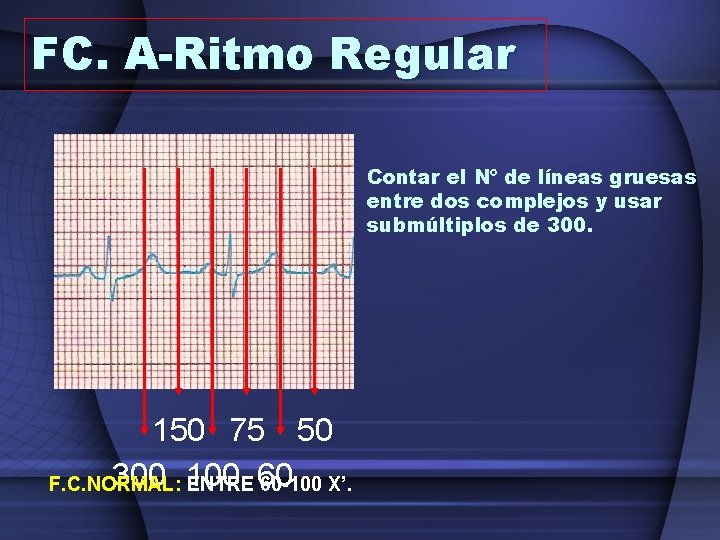 FC. A-Ritmo Regular Contar el Nº de líneas gruesas entre dos complejos y usar