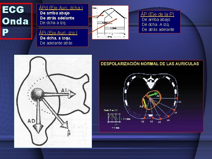 ECG Onda P Pd (Eje Auri. dcha. ) De arriba abajo De atrás adelante