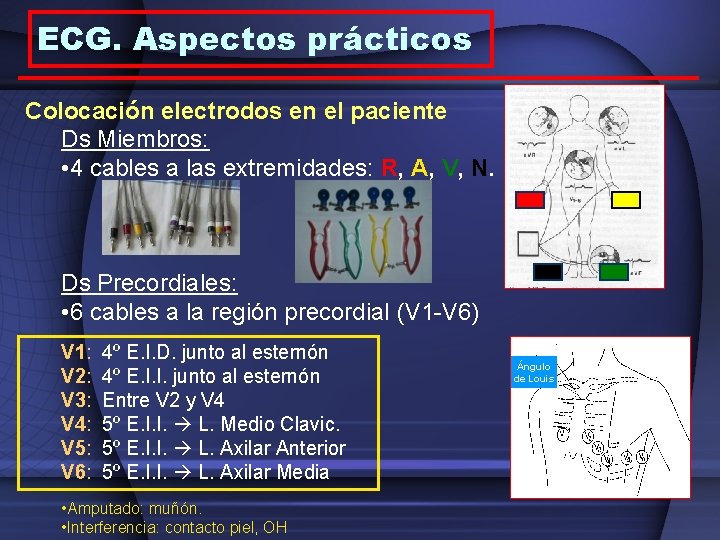 ECG. Aspectos prácticos Colocación electrodos en el paciente Ds Miembros: • 4 cables a