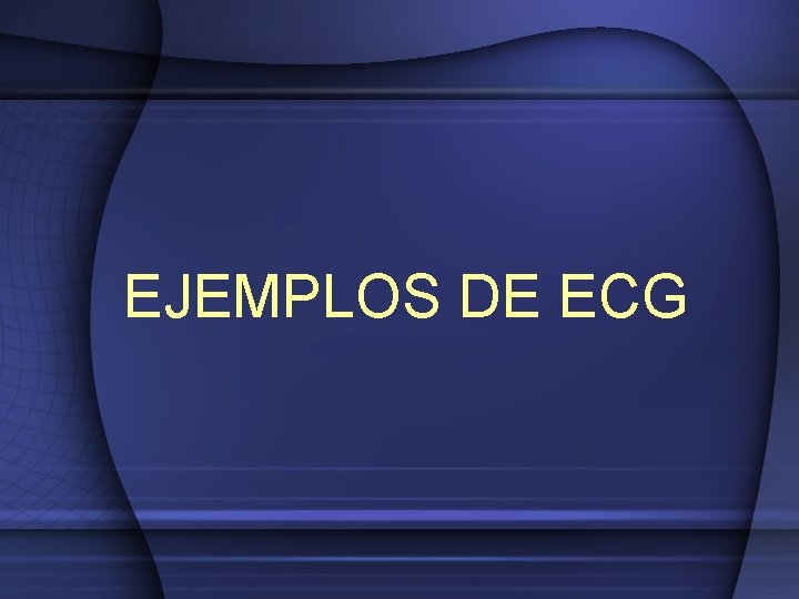 EJEMPLOS DE ECG 