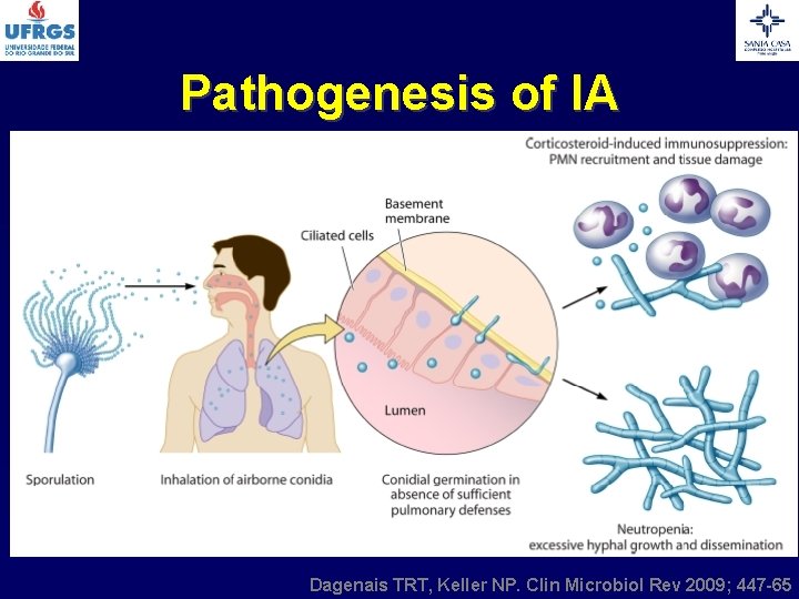 Pathogenesis of IA Dagenais TRT, Keller NP. Clin Microbiol Rev 2009; 447 -65 