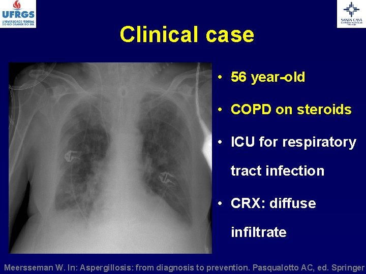 Clinical case • 56 year-old • COPD on steroids • ICU for respiratory tract