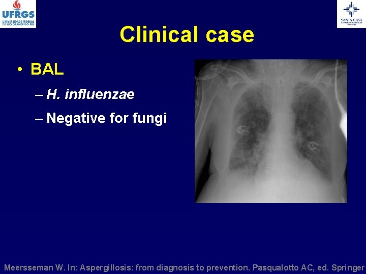 Clinical case • BAL – H. influenzae – Negative for fungi Meersseman W. In: