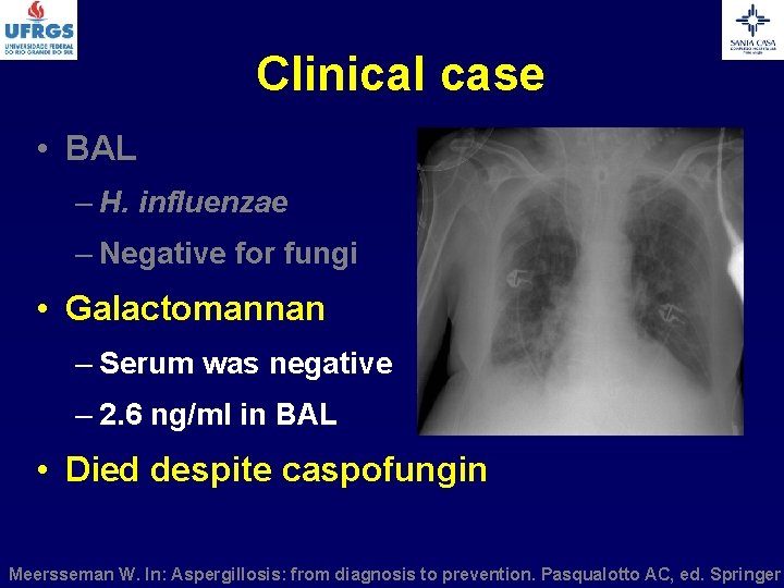 Clinical case • BAL – H. influenzae – Negative for fungi • Galactomannan –