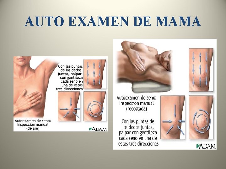 AUTO EXAMEN DE MAMA 