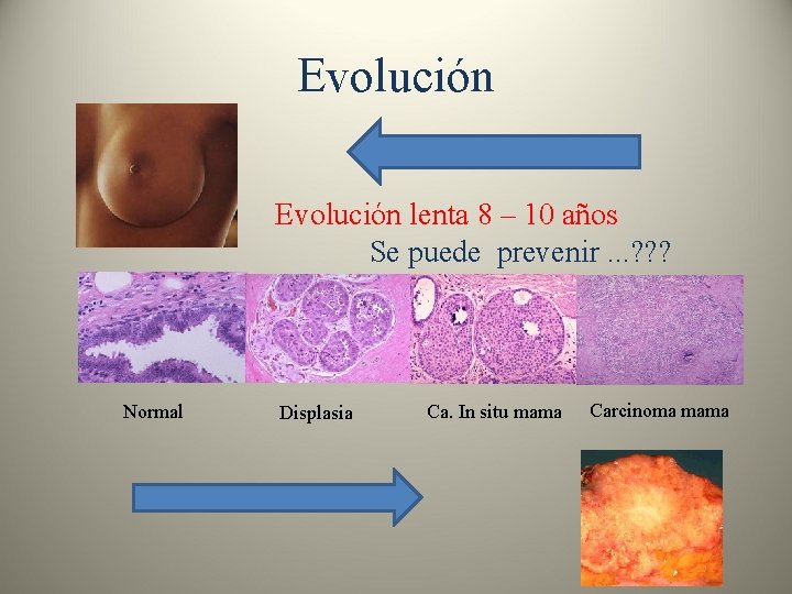 Evolución lenta 8 – 10 años Se puede prevenir. . . ? ? ?