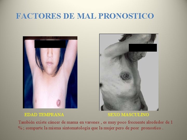 FACTORES DE MAL PRONOSTICO EDAD TEMPRANA SEXO MASCULINO También existe cáncer de mama en