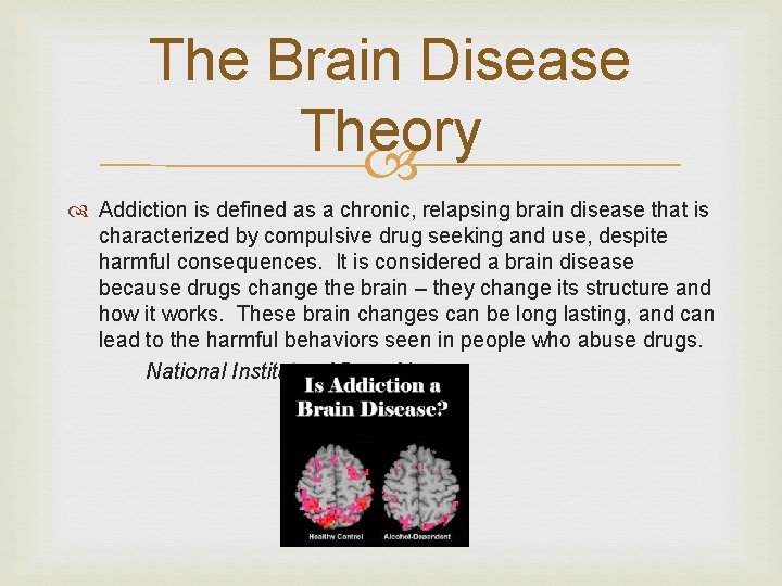 The Brain Disease Theory Addiction is defined as a chronic, relapsing brain disease that