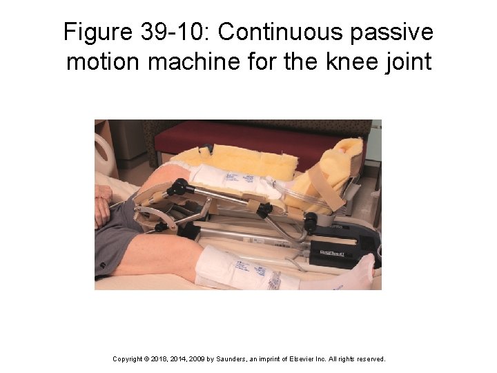 Figure 39 -10: Continuous passive motion machine for the knee joint Copyright © 2018,