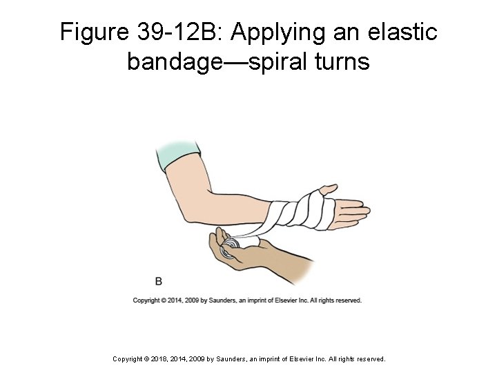 Figure 39 -12 B: Applying an elastic bandage—spiral turns Copyright © 2018, 2014, 2009