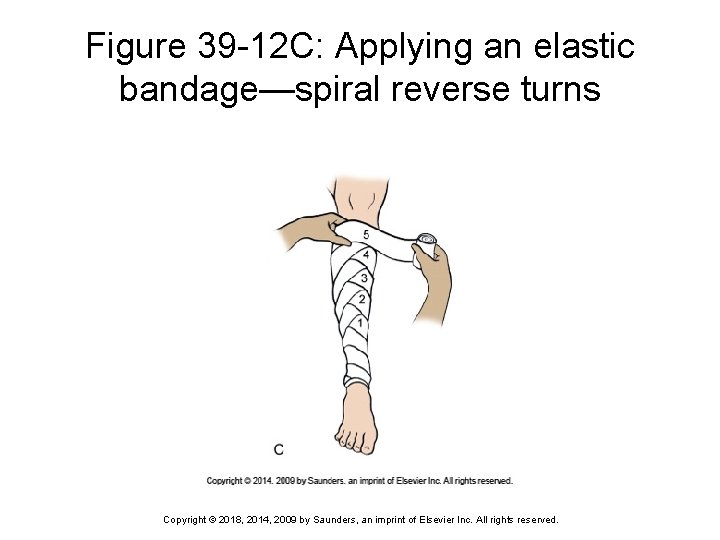 Figure 39 -12 C: Applying an elastic bandage—spiral reverse turns Copyright © 2018, 2014,