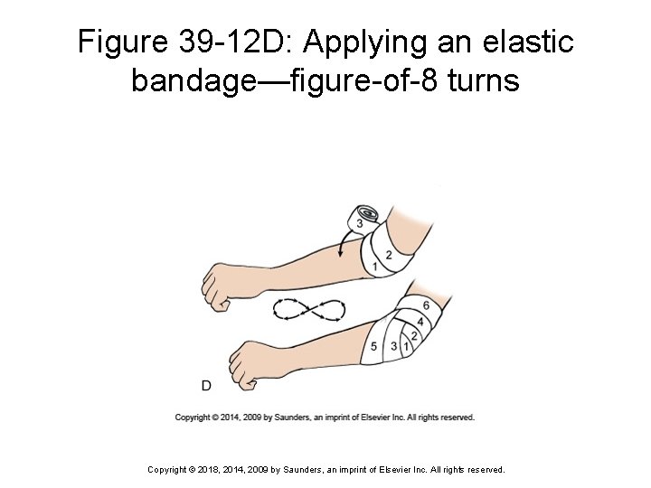 Figure 39 -12 D: Applying an elastic bandage—figure-of-8 turns Copyright © 2018, 2014, 2009