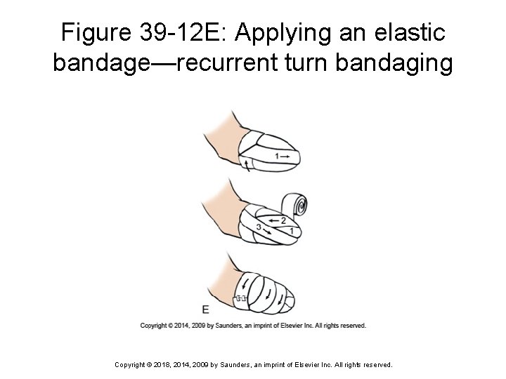 Figure 39 -12 E: Applying an elastic bandage—recurrent turn bandaging Copyright © 2018, 2014,