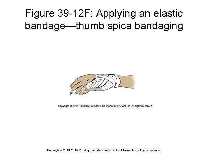 Figure 39 -12 F: Applying an elastic bandage—thumb spica bandaging Copyright © 2018, 2014,