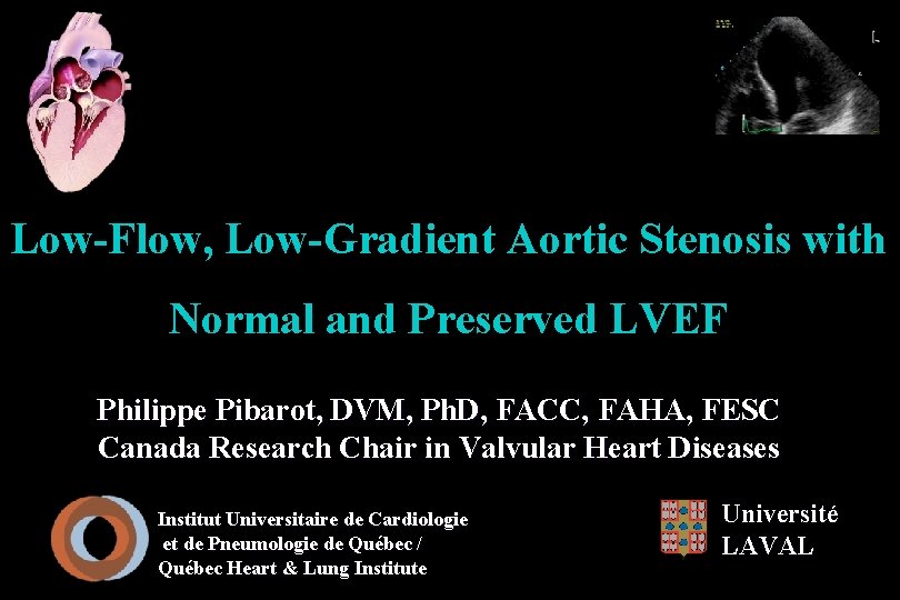 Low-Flow, Low-Gradient Aortic Stenosis with Normal and Preserved LVEF Philippe Pibarot, DVM, Ph. D, Low-Flow, Low-Gradient Aortic Stenosis with Normal and Preserved LVEF Philippe Pibarot, DVM, Ph. D,