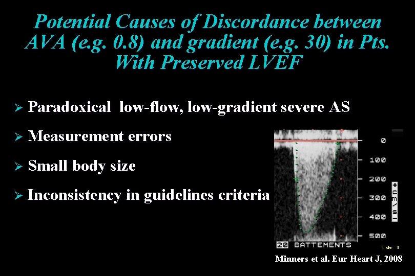 Potential Causes of Discordance between AVA (e. g. 0. 8) and gradient (e. g. Potential Causes of Discordance between AVA (e. g. 0. 8) and gradient (e. g.