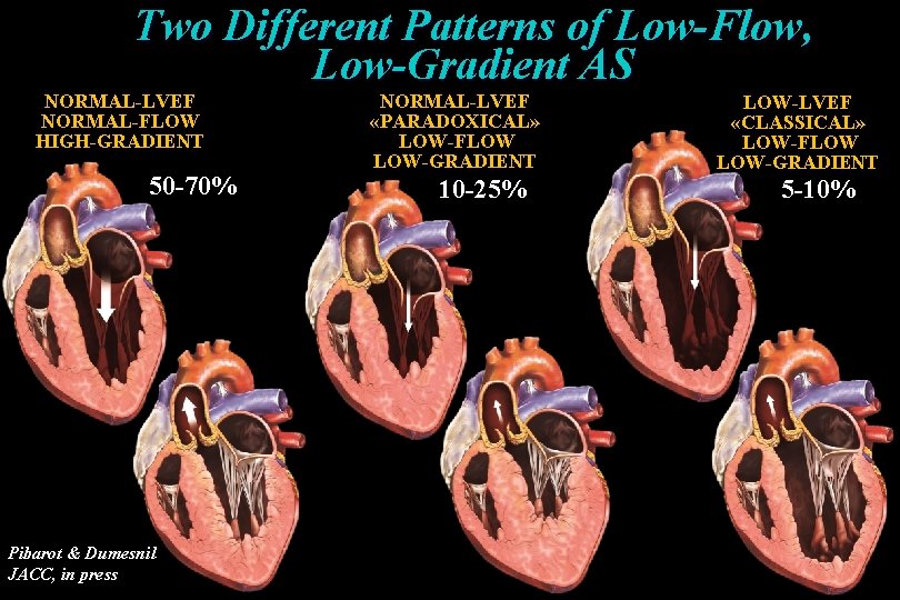 Two Different Patterns of Low-Flow, Low-Gradient AS NORMAL-LVEF NORMAL-FLOW HIGH-GRADIENT 50 -70% Pibarot & Two Different Patterns of Low-Flow, Low-Gradient AS NORMAL-LVEF NORMAL-FLOW HIGH-GRADIENT 50 -70% Pibarot &