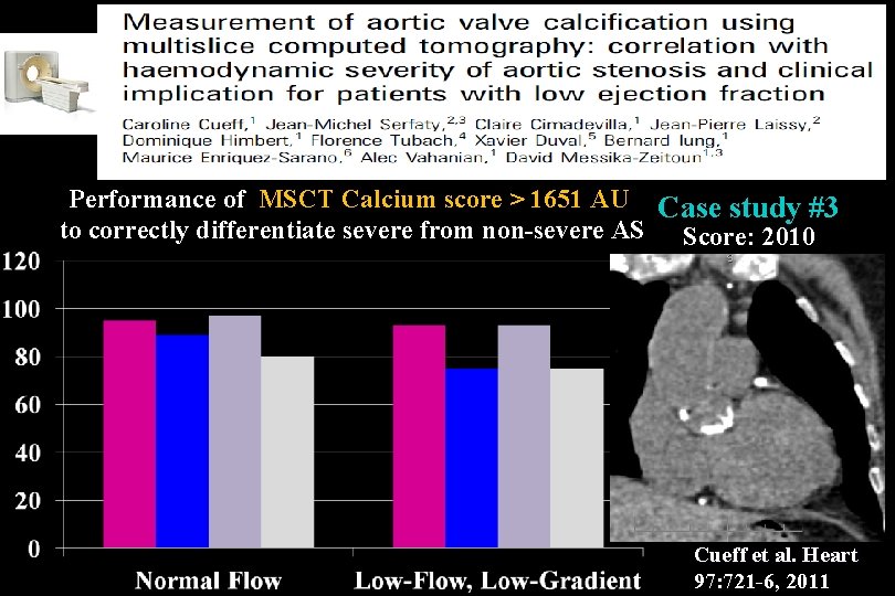 Performance of MSCT Calcium score > 1651 AU Case study #3 to correctly differentiate Performance of MSCT Calcium score > 1651 AU Case study #3 to correctly differentiate