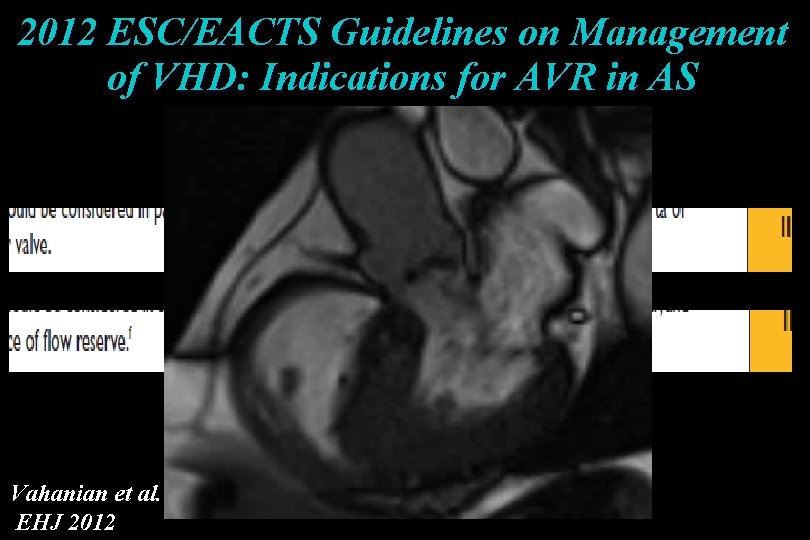 2012 ESC/EACTS Guidelines on Management of VHD: Indications for AVR in AS Vahanian et 2012 ESC/EACTS Guidelines on Management of VHD: Indications for AVR in AS Vahanian et