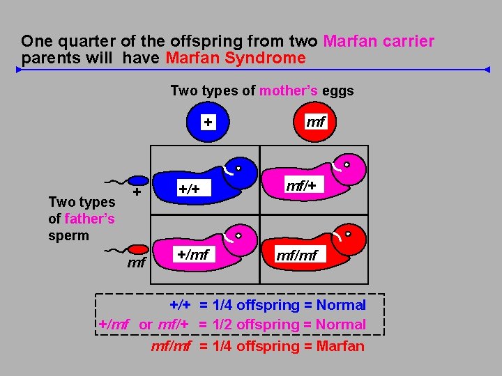 One quarter of the offspring from two Marfan carrier parents will have Marfan Syndrome