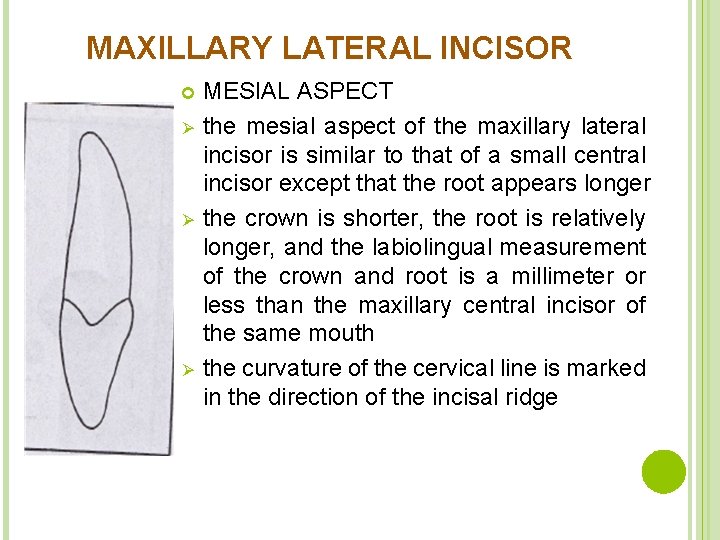 MAXILLARY LATERAL INCISOR Ø Ø Ø MESIAL ASPECT the mesial aspect of the maxillary