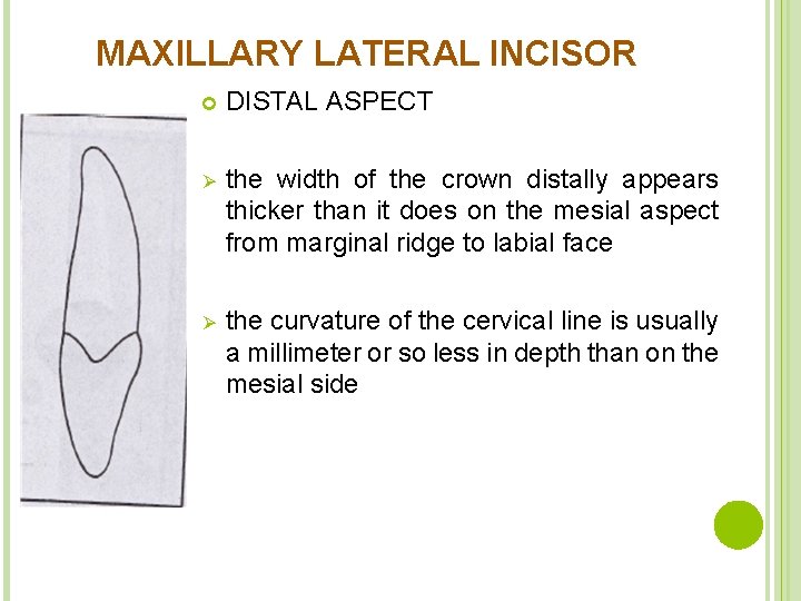 MAXILLARY LATERAL INCISOR DISTAL ASPECT Ø the width of the crown distally appears thicker