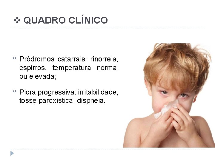 v QUADRO CLÍNICO Pródromos catarrais: rinorreia, espirros, temperatura normal ou elevada; Piora progressiva: irritabilidade,