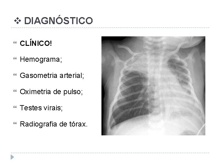 v DIAGNÓSTICO CLÍNICO! Hemograma; Gasometria arterial; Oximetria de pulso; Testes virais; Radiografia de tórax.