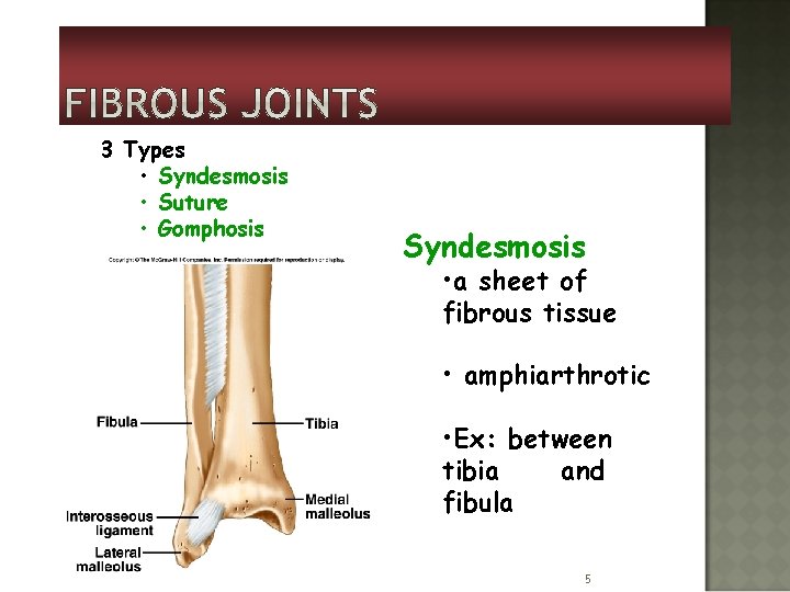 3 Types • Syndesmosis • Suture • Gomphosis Syndesmosis • a sheet of fibrous