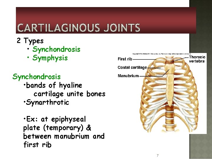 2 Types • Synchondrosis • Symphysis Synchondrosis • bands of hyaline cartilage unite bones