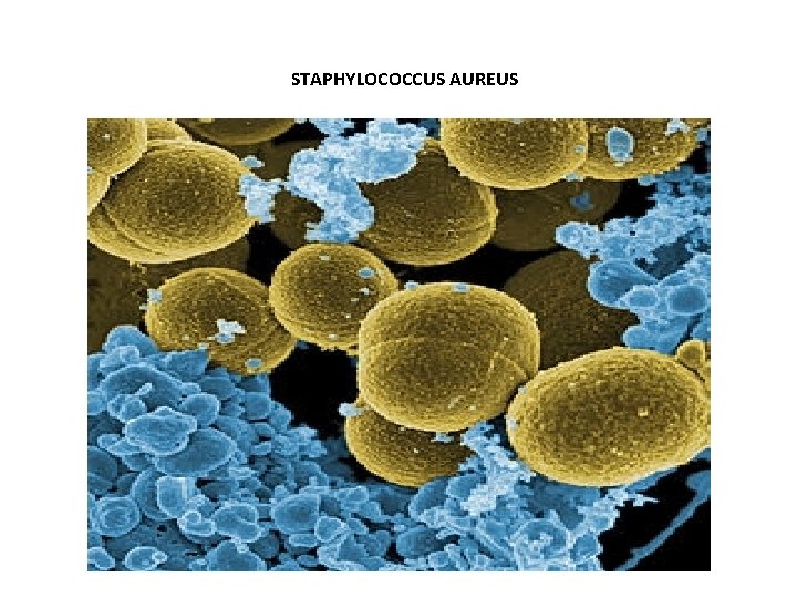 STAPHYLOCOCCUS AUREUS 