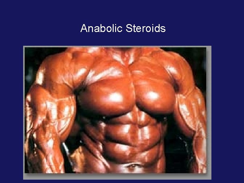 Anabolic Steroids 