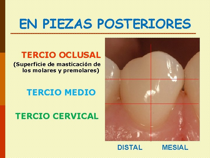 EN PIEZAS POSTERIORES TERCIO OCLUSAL (Superficie de masticación de los molares y premolares) TERCIO