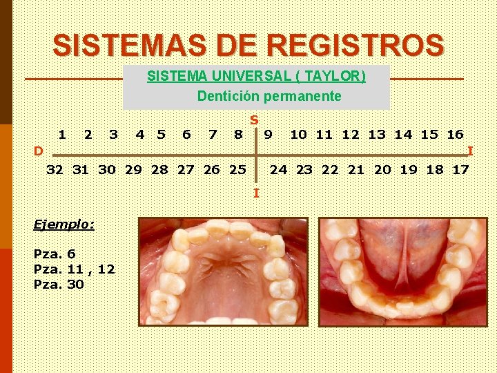SISTEMAS DE REGISTROS SISTEMA UNIVERSAL ( TAYLOR) Dentición permanente 1 2 3 4 5