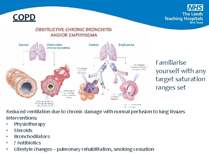 COPD Familiarise yourself with any target saturation ranges set Reduced ventilation due to chronic