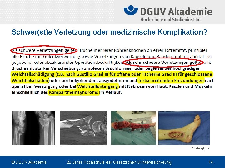 Schwer(st)e Verletzung oder medizinische Komplikation? © Schweigkofler © DGUV Akademie 20 Jahre Hochschule der