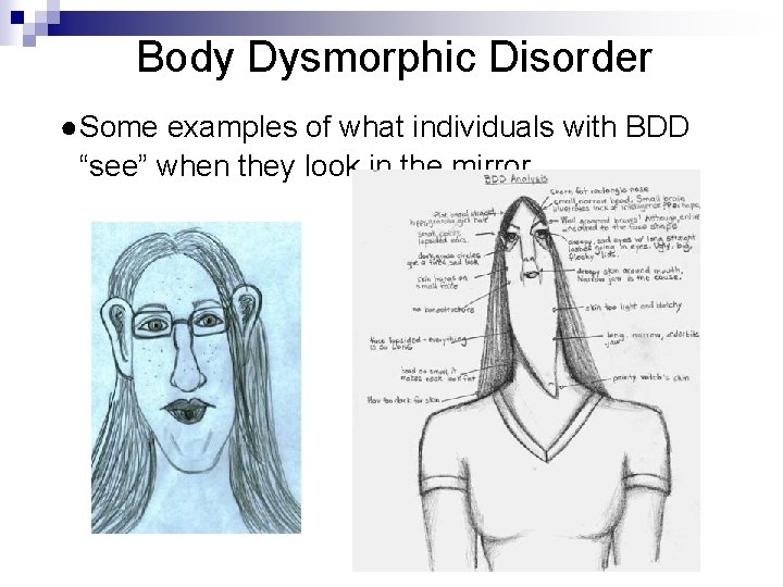 Body Dysmorphic Disorder ●Some examples of what individuals with BDD “see” when they look