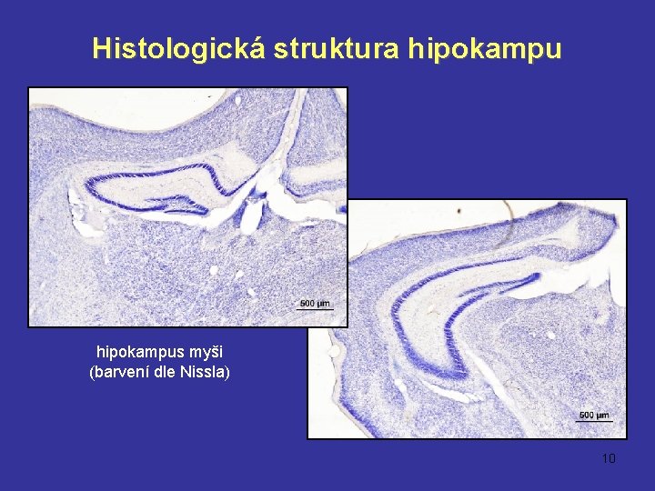 Histologická struktura hipokampus myši (barvení dle Nissla) 10 