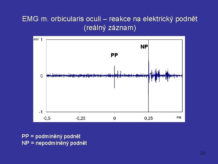 EMG m. orbicularis oculi – reakce na elektrický podnět (reálný záznam) NP PP PP