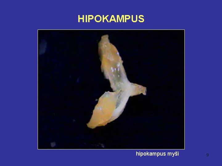 HIPOKAMPUS hipokampus myši 9 