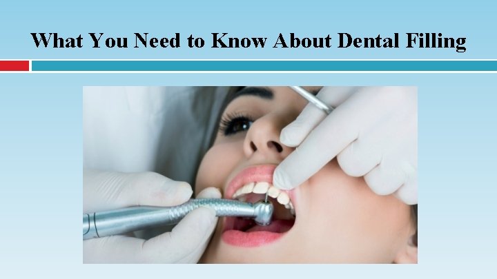 What You Need to Know About Dental Filling 