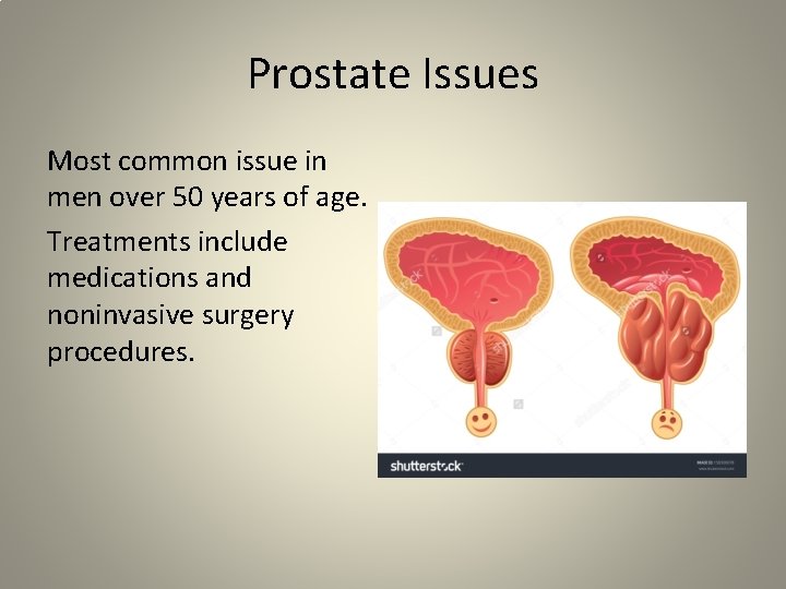 Prostate Issues Most common issue in men over 50 years of age. Treatments include