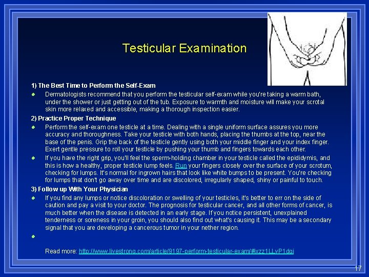 Testicular Examination 1) The Best Time to Perform the Self-Exam l Dermatologists recommend that